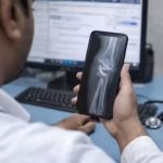 फोन पर एक्स-रे देख कर दिया 9 साल के बच्चे का प्लास्टर, एक महीने बाद खोला तो उड़ गए होश, जानें पूरा मामला